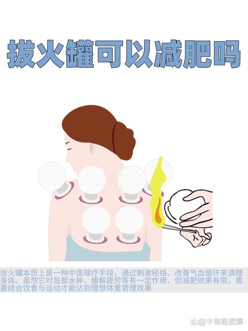 拔罐减肥封罐后的饮食