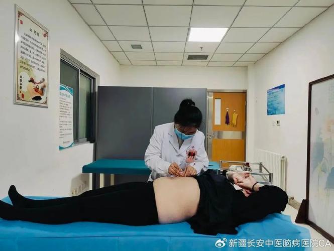 北京中医院 埋线减肥