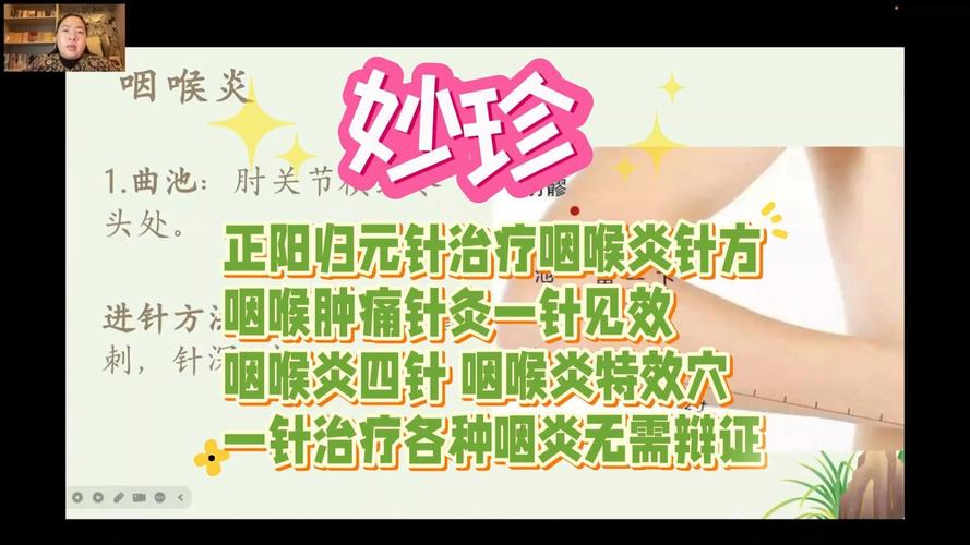 注射穴位治疗慢性咽炎