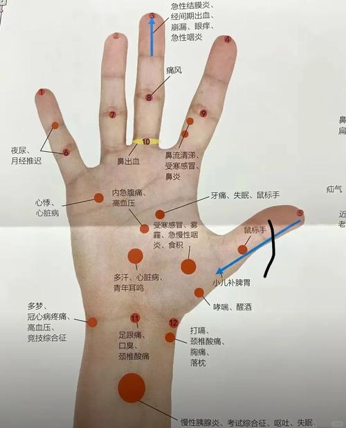 牙疼刺激手上哪个穴位