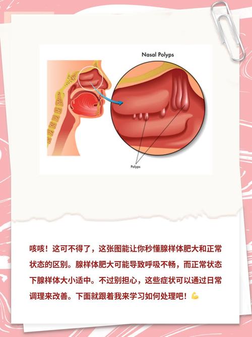 中医腺样体肥大辩证论