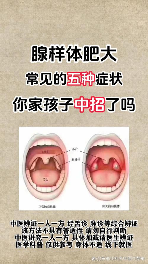 中医腺样体肥大辩证论
