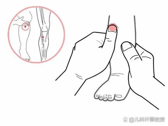 小儿疝气如何按摩穴位