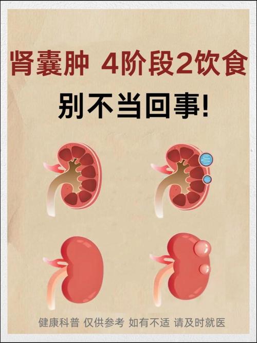 左肾囊肿饮食注意事项