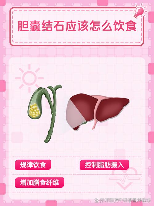 胆结石病人的日常饮食