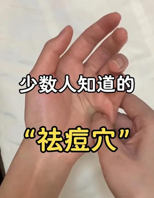 艾灸痘痘面部哪个穴位