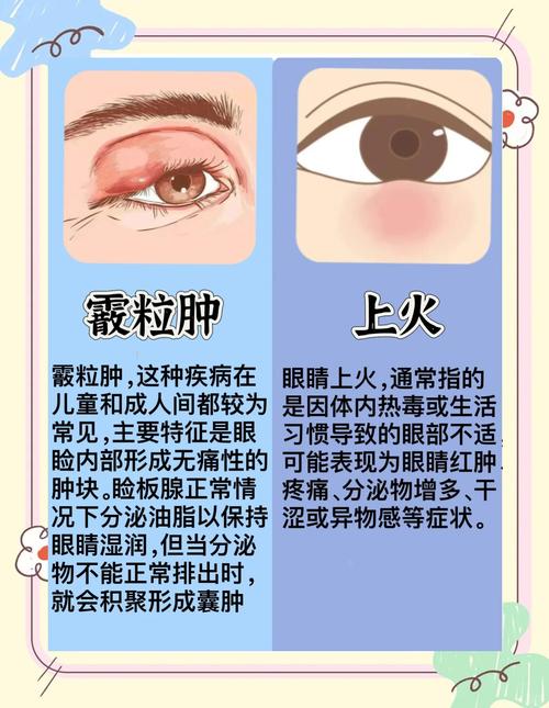 霰粒肿中医有什么办法