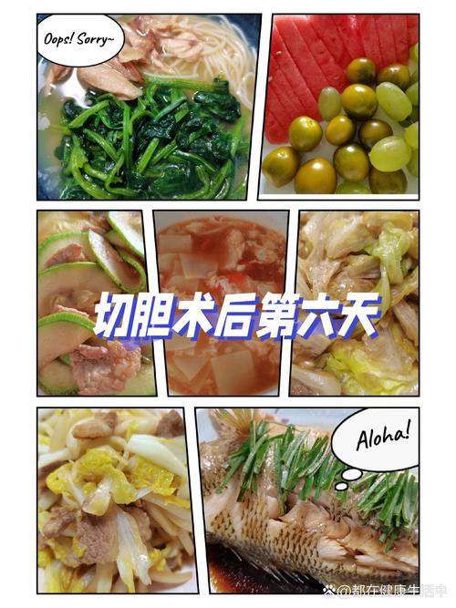 腹腔镜胆囊切除术饮食