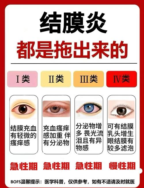 病毒性结膜炎饮食禁忌