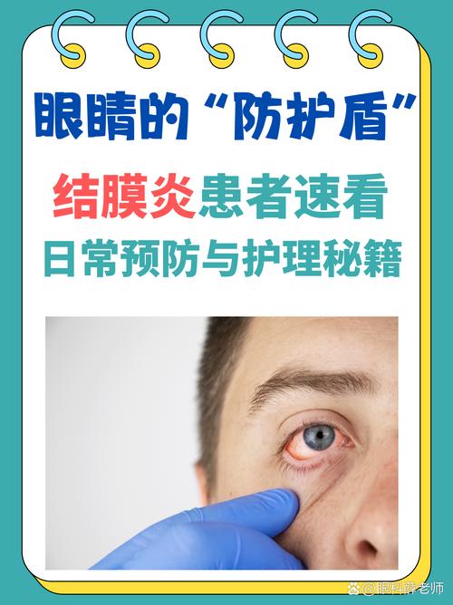 病毒性结膜炎饮食禁忌