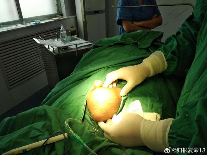 鞘膜积液中医治疗案例