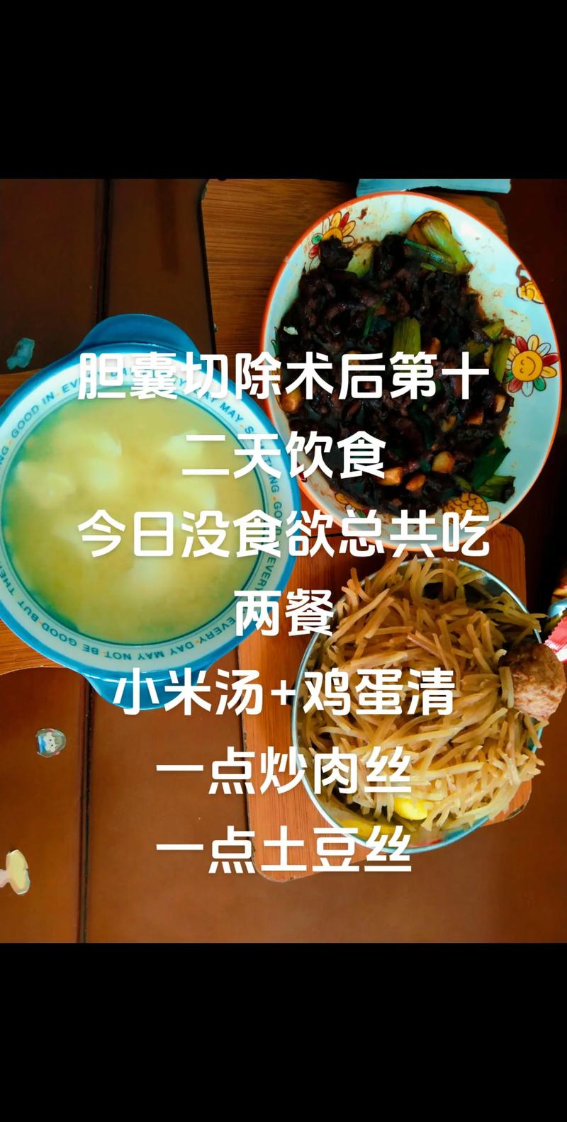 胆囊微创切除后的饮食