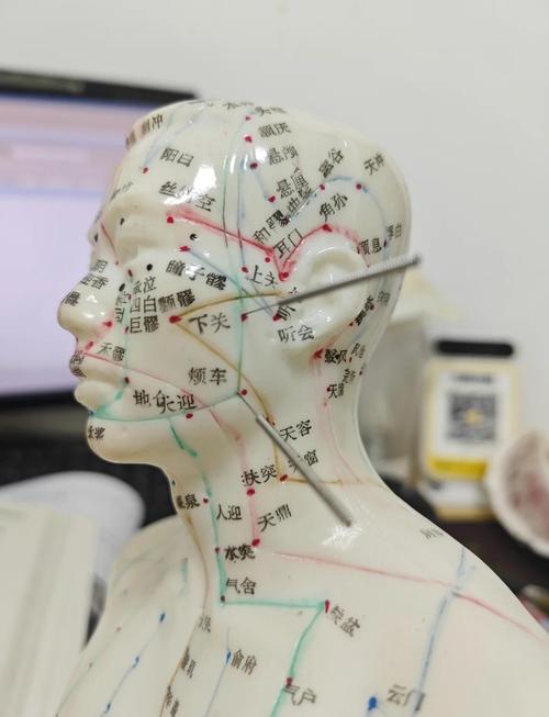 牙龈出血 穴位按摩