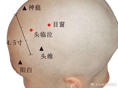眼睛黄斑病变 穴位