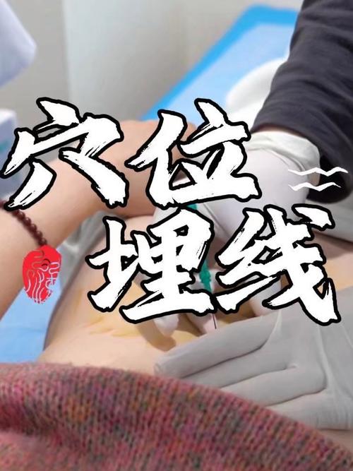 中医埋线减肥操作视频
