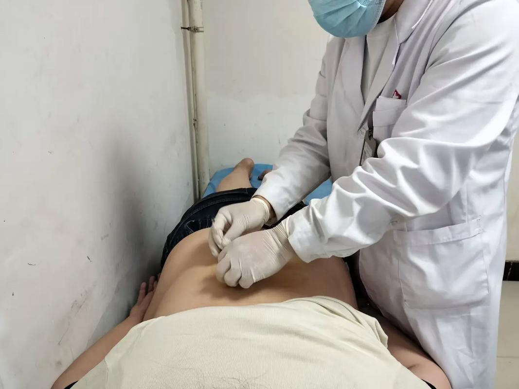 中医埋线减肥操作视频