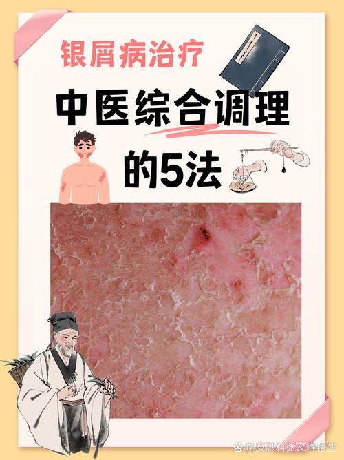 皮炎看中医还是西医好