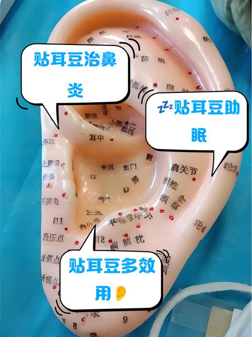 耳聋用穴位贴什么穴位