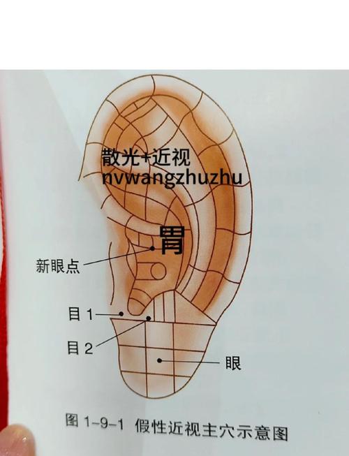耳聋用穴位贴什么穴位