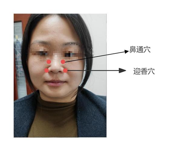 眼睛下面鼻子旁边穴位