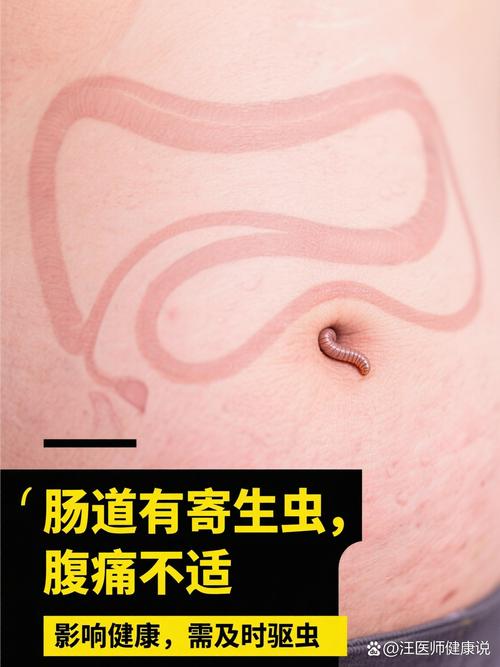 肠虫清饮食上注意什么