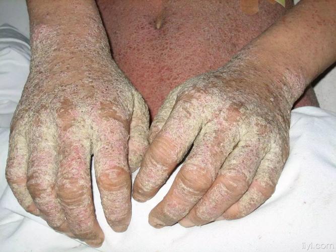 云南省中医皮肤科坑吗