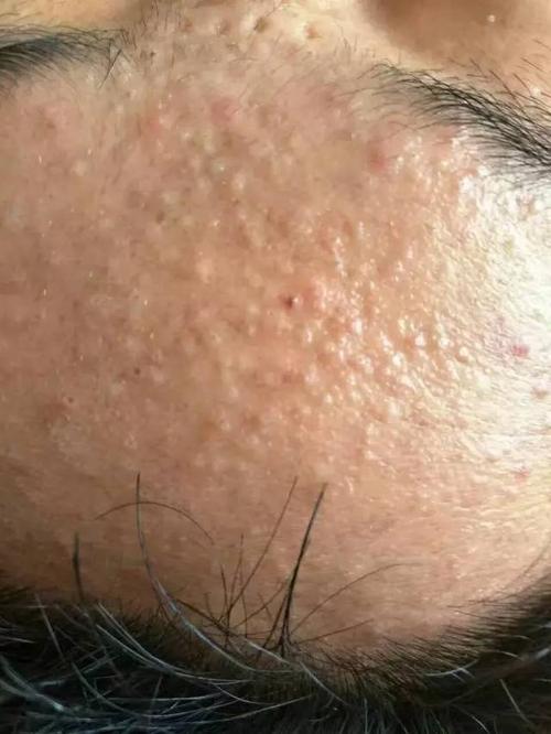 云南省中医皮肤科坑吗