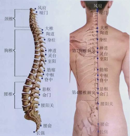坐骨神经痛拔罐穴位图