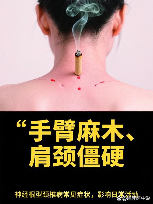 颈椎病用艾灸什么穴位