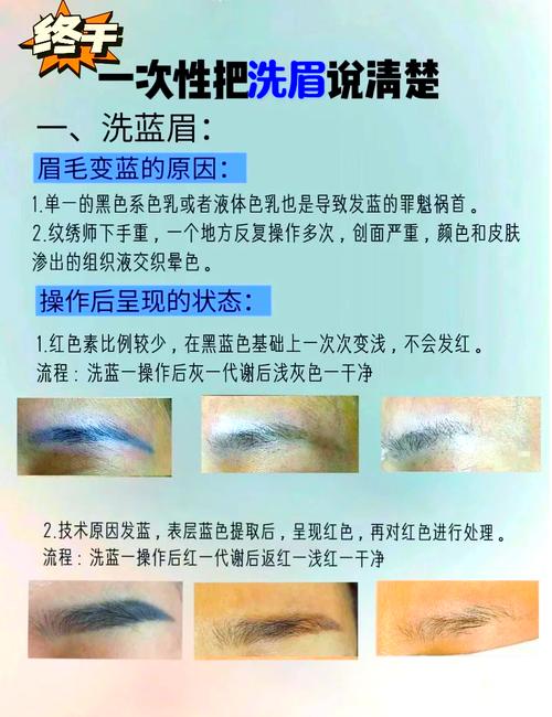 洗眉毛后饮食注意什么