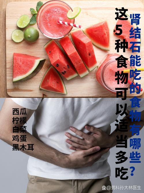 肾结石适应吃什么饮食