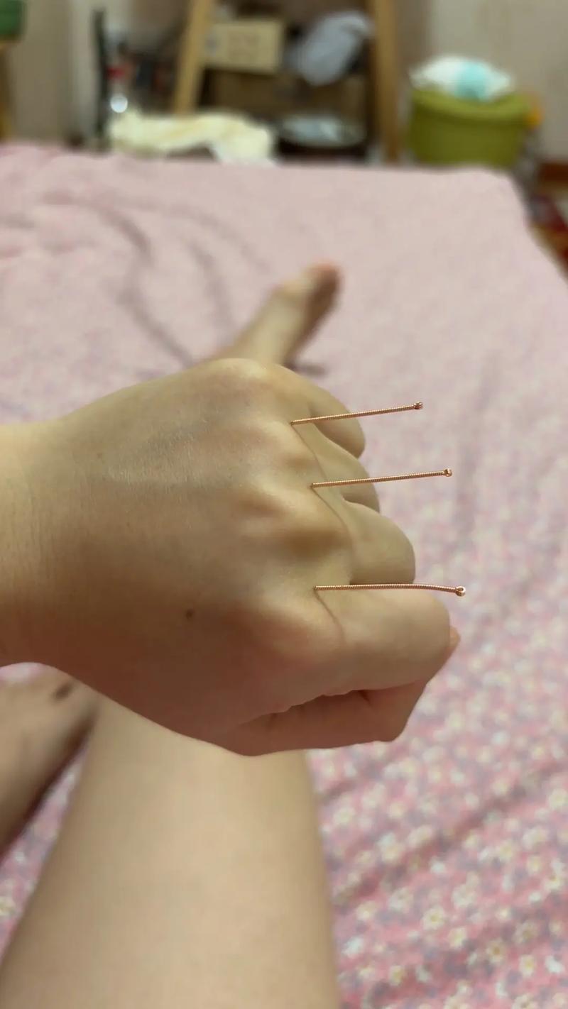 三叉神经痛按什么穴位