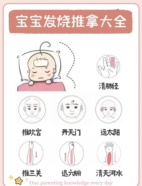 宝宝发烧刺什么穴位