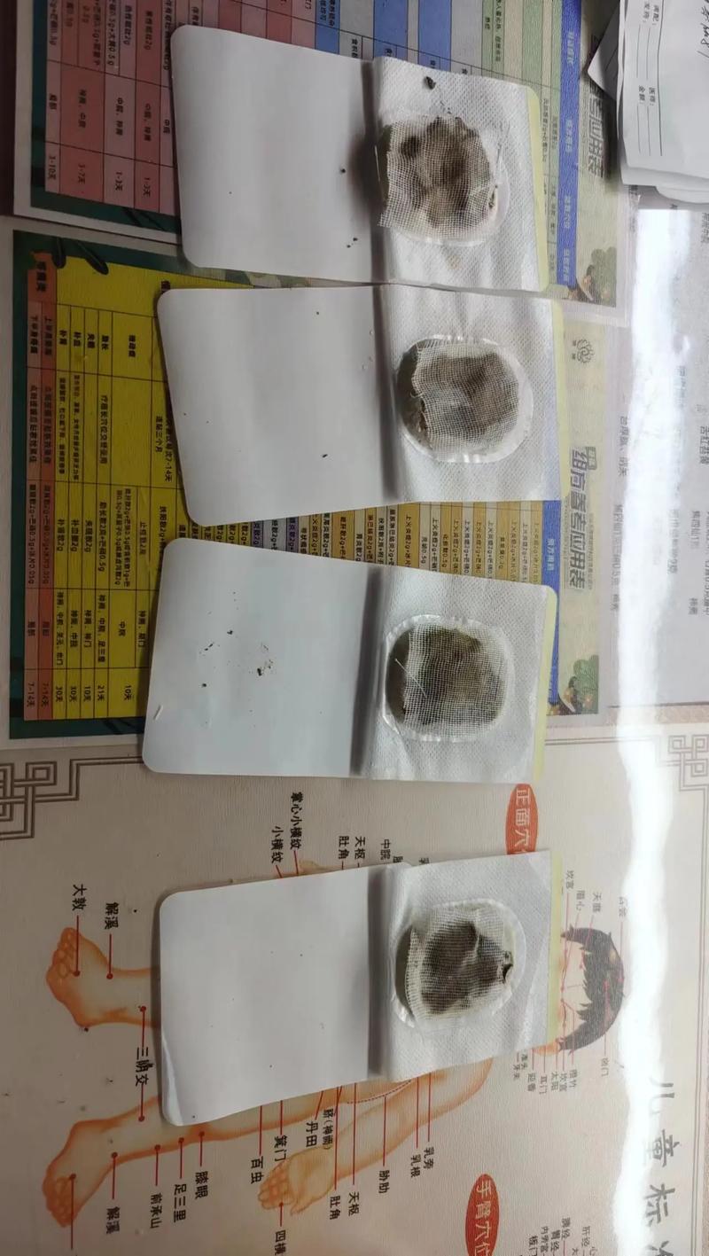 咳嗽穴位贴中药成分