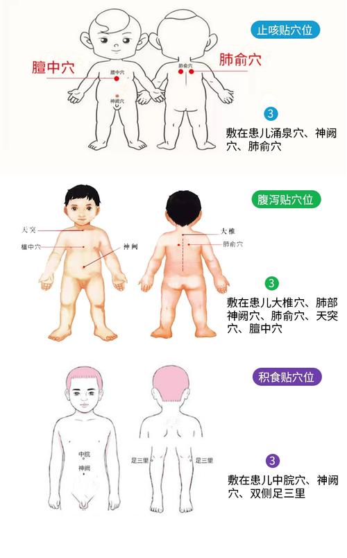 修正儿童退热穴位贴