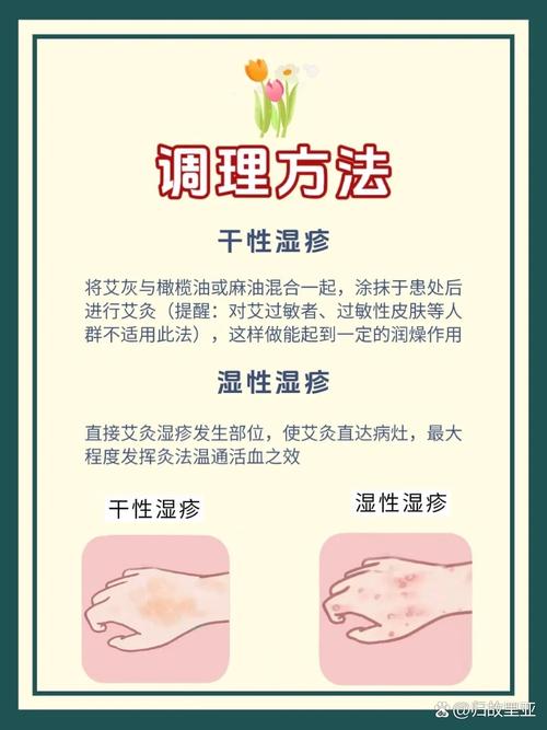 过敏性湿疹中医怎么治