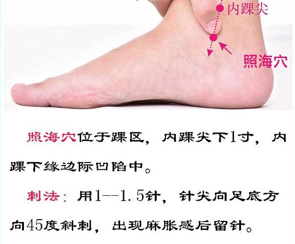 癫痫的穴位治疗方法