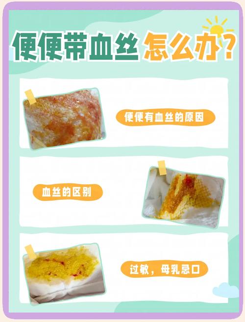 宝宝便秘带血饮食调理