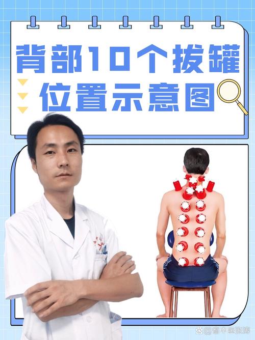 什么穴位不能拔罐子