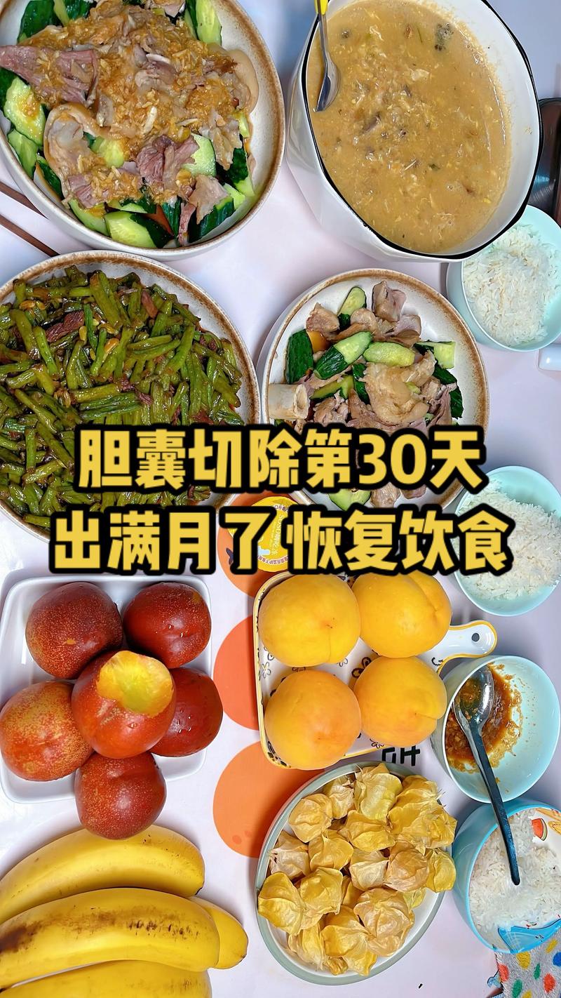 微创胆管结石术后饮食