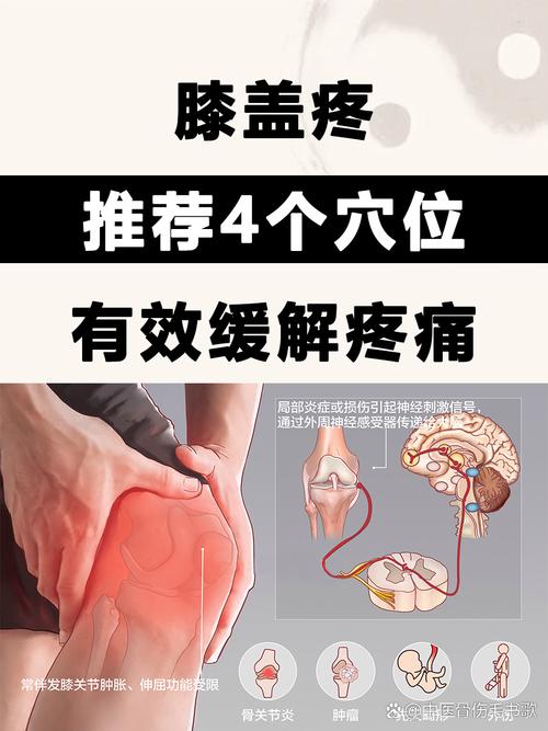 膝盖疼安神什么穴位