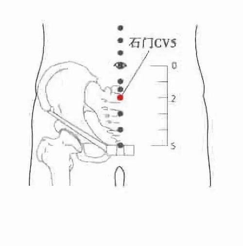 石门穴位位置及作用