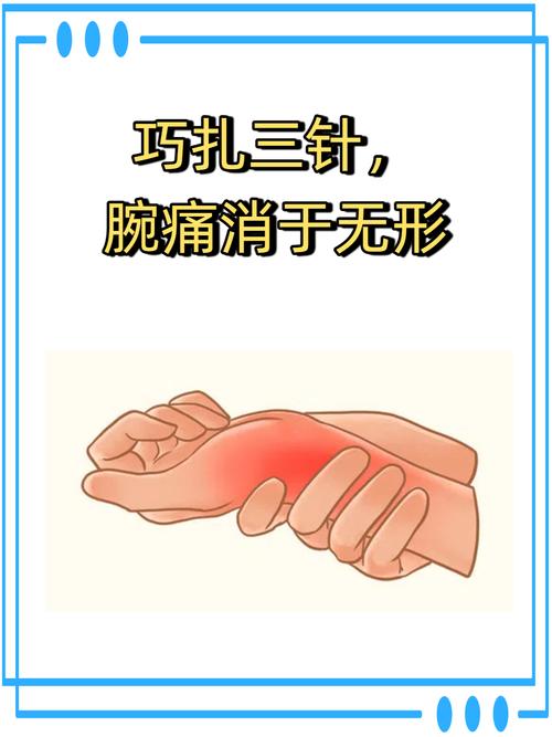 手腕部扭伤穴位治疗