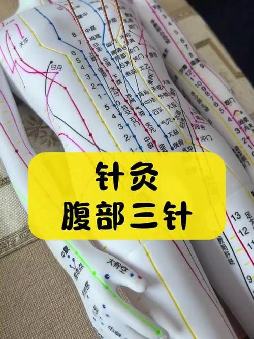 腹针常用穴位有哪些