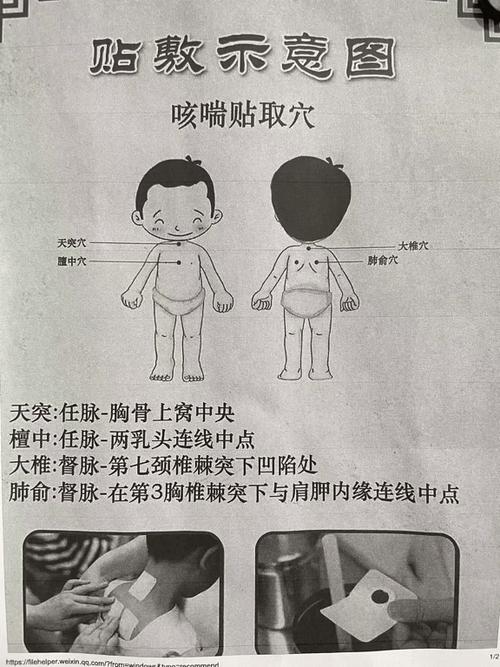 感冒咳嗽穴位贴哪里