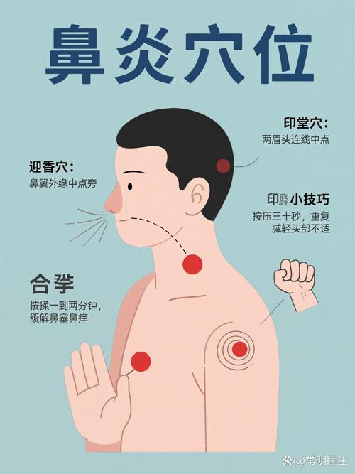 身体过敏掐哪个穴位