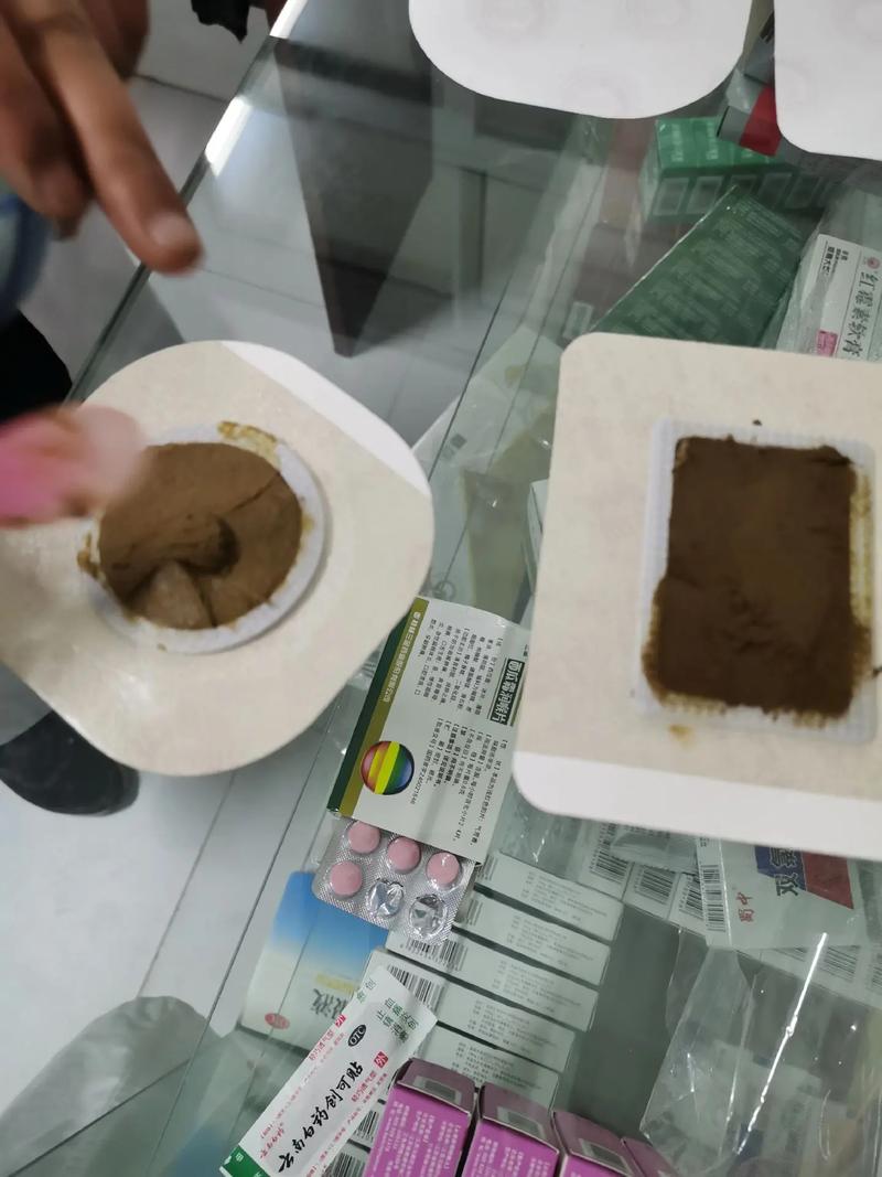 东方医院的穴位敷贴