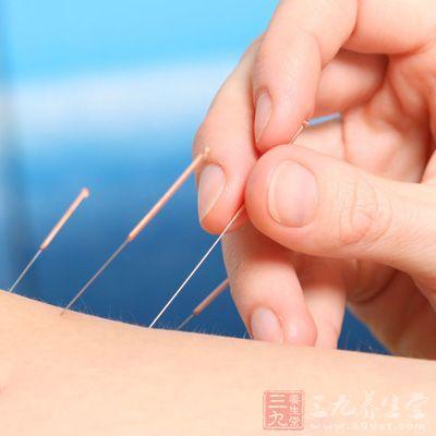 滑膜炎艾灸穴位针灸