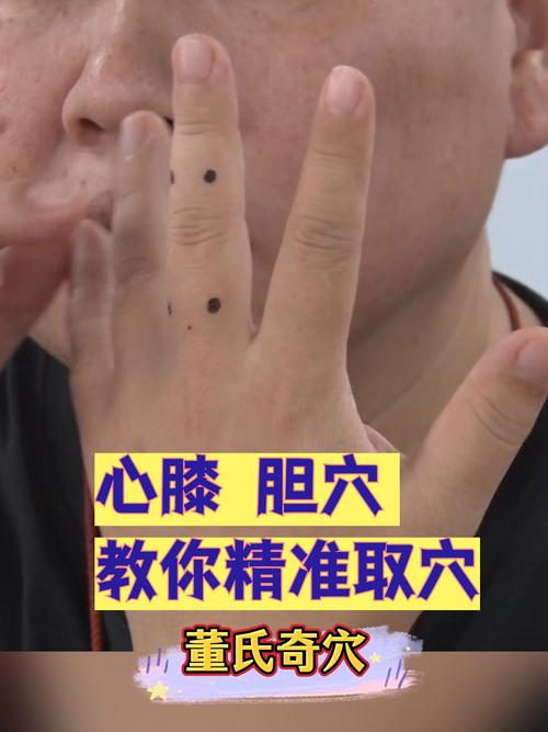 哪个穴位调理胆结石