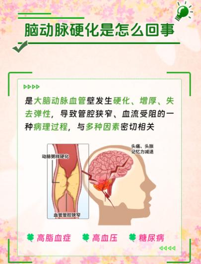 脑动脉硬化的饮食疗法